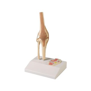 Articulation miniature du genou avec coupe transversale