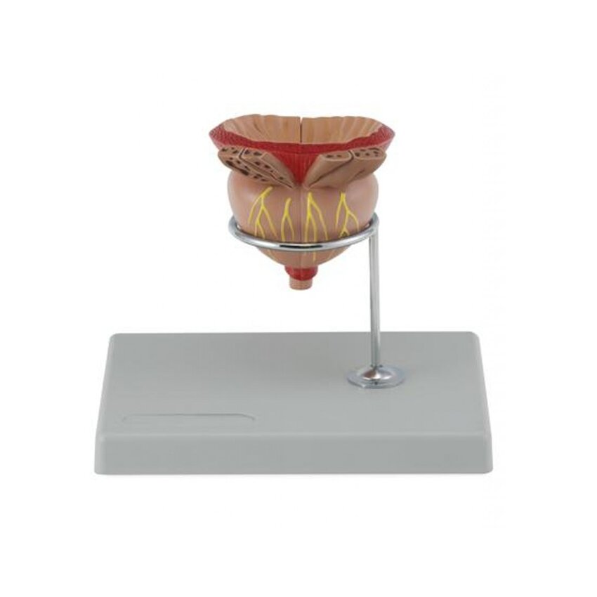 Modèle de prostate