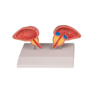 Modèle de prostate, en 2 parties