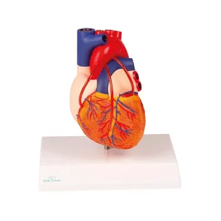 Coeur avec pontage