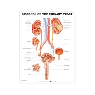 Maladies des voies urinaires en anglais sur film plastique PET brillant