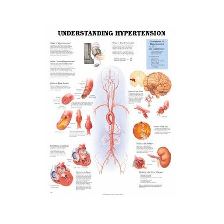Comprendre l'hypertension artérielle Affiche plastifiée 51x66 cm