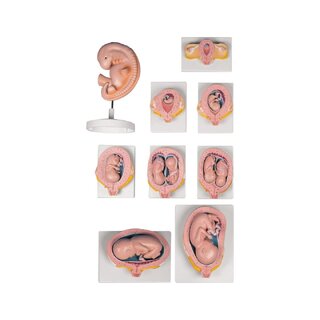 Coffret de 9 modèles de grossesse