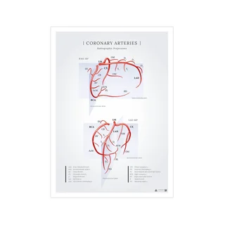 Affiche sur les artères coronaires du coeur vues en projections radiographiques