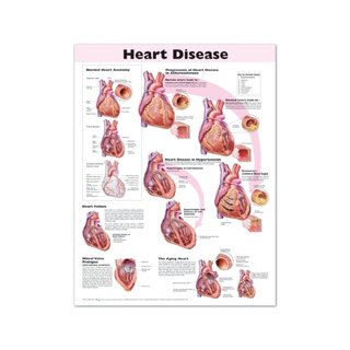 Affiche plastifiée sur les maladies cardiaques en anglais