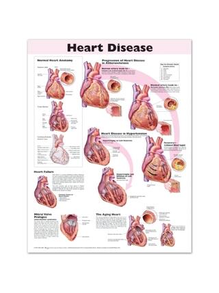 Affiche plastifiée sur les maladies cardiaques en anglais