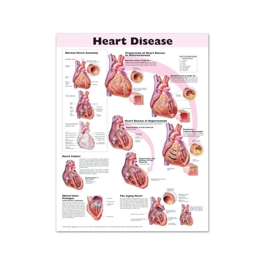 Affiche plastifiée sur les maladies cardiaques en anglais