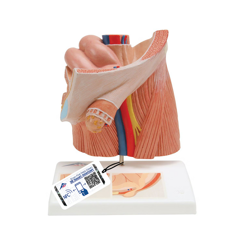 Modèle urologique de hernie inguinale