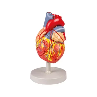 Coeur avec pontage, 2x taille naturelle, 4 parties