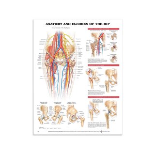 Affiche - Anatomie et lésions de l'articulation de la hanche en anglais