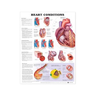 Affiche plastifiée sur les maladies cardiaques