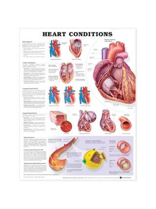 Affiche plastifiée sur les maladies cardiaques