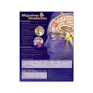 Planche pédagogique Migraine et céphalées, plastifiée 51x66 cm (en anglais)