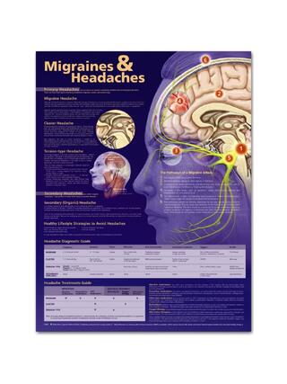 Planche pédagogique Migraine et céphalées, plastifiée 51x66 cm (en anglais)