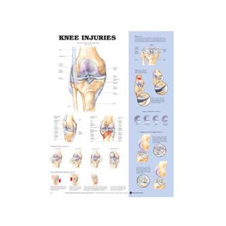 Affiche sur les blessures au genou (anglais)