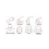Lot de 4 ventouses en silicone pour ventouses