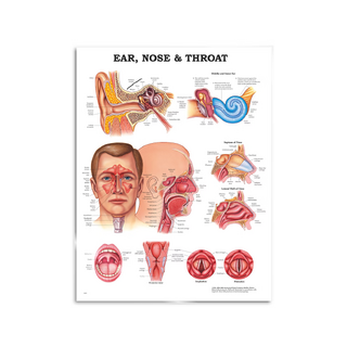 Oto-rhino-laryngologie - affiche 51x66 cm