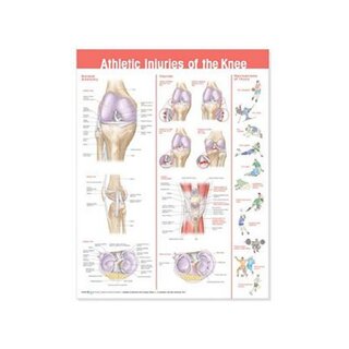 Affiche plastifiée sur les blessures au genou après un sport (anglais)