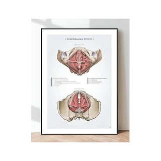 Affiche Diaphragme du bassin - plancher pelvien chez la femme