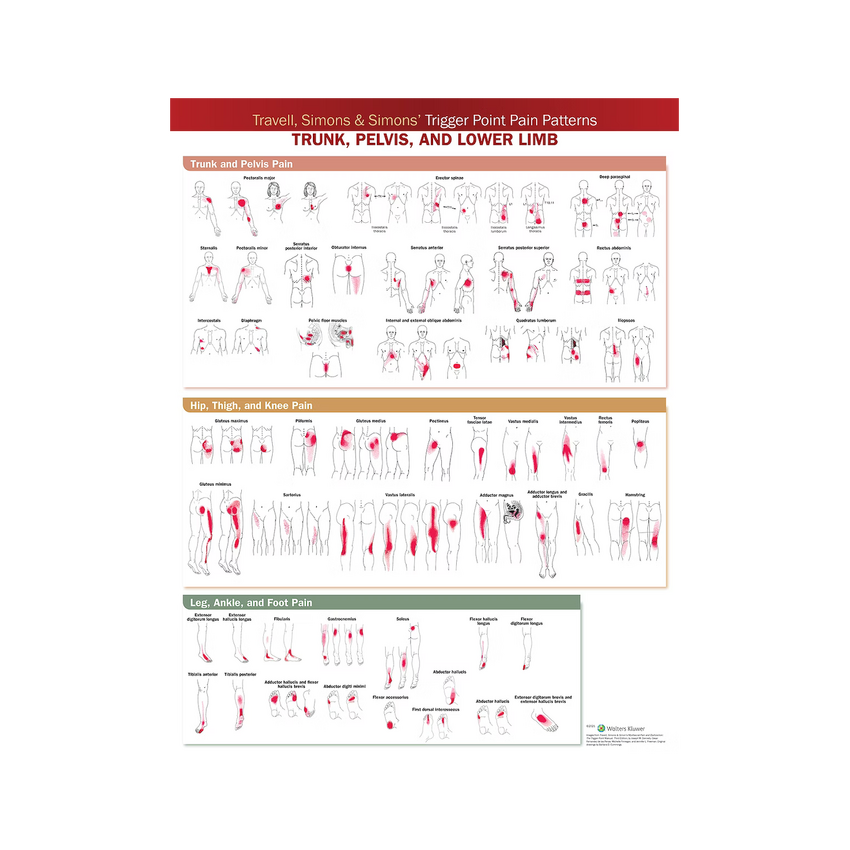Affiche sur les points de déclenchement développée par Travell & Simons