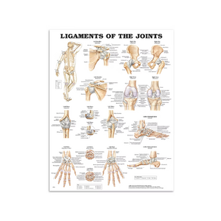 Panneau stratifié avec joints et ligaments