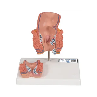 Modèle du rectum montrant des hémorroïdes