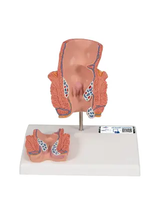 Modèle du rectum montrant des hémorroïdes