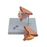 Modèle de prostate