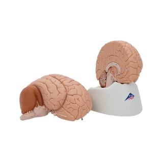 Moulage classique du cerveau réel