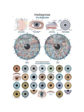 Diagramme de diagnostic de l'iris, tableau d'anatomie 50x70cm